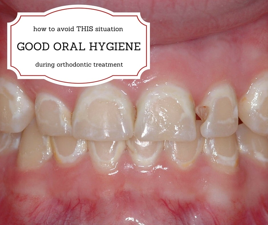 tips for good oral hygiene